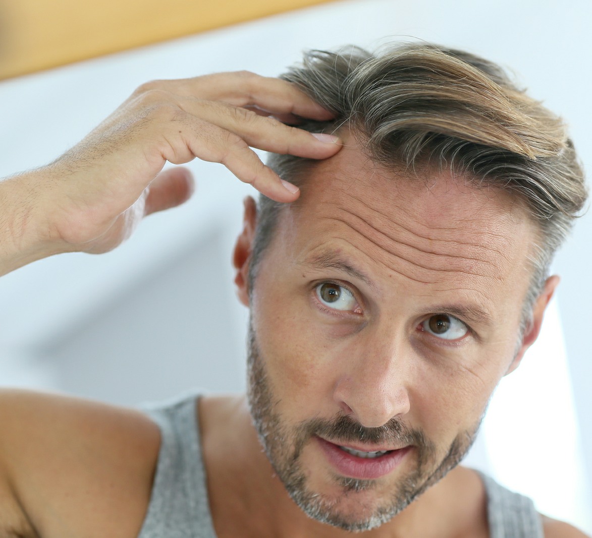 hair restoration for men